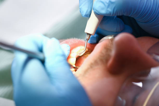 Best Emergency Dental Care for Broken or Chipped Teeth in Dover Beaches South, NJ
