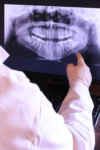 Best Emergency Treatment for Dental Infections or Abscesses in Dover Beaches South, NJ